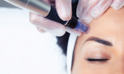 Laser Infra Rouge avec Microneedling