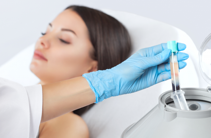 PRP microneedling et Laser