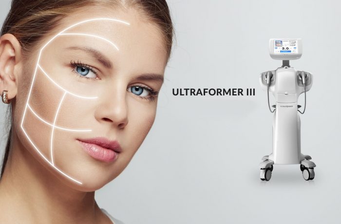 Ultraformer III